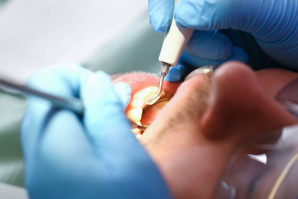 Best Orthodontic Emergency Dentist in Vienna, WV