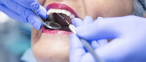 Best Emergency Root Canal Treatment in Vienna, WV